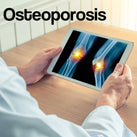 A white panel with the word – Osteoporosis – on it